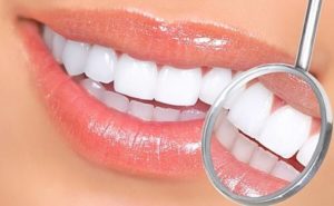 Керамічні коронки на зуби у Дніпрі: детальний огляд