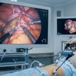 Лапароскопическая хирургия: точная медицина малых разрезов и быстрых решений